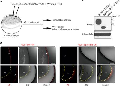 Identification of a dysfunctional exon-skipping splice variant in GLUT9/SLC2A9 causal for renal hypouricemia type 2